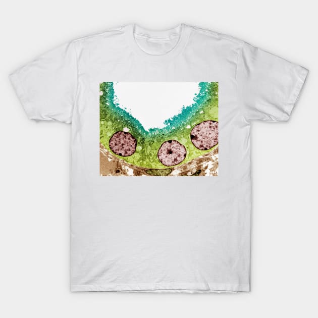 Kidney tubule, TEM (P550/0208) T-Shirt by SciencePhoto